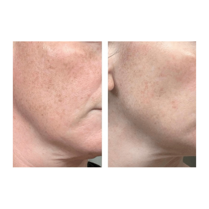 DARK SPOT CORRECTOR SERUM