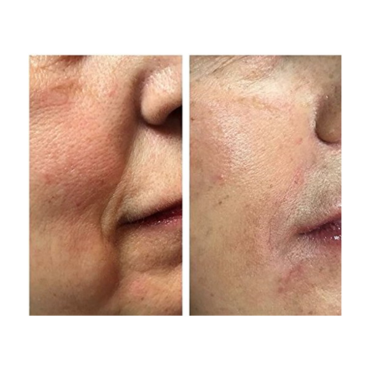 PEPTIDE COMPLEX BOOSTER