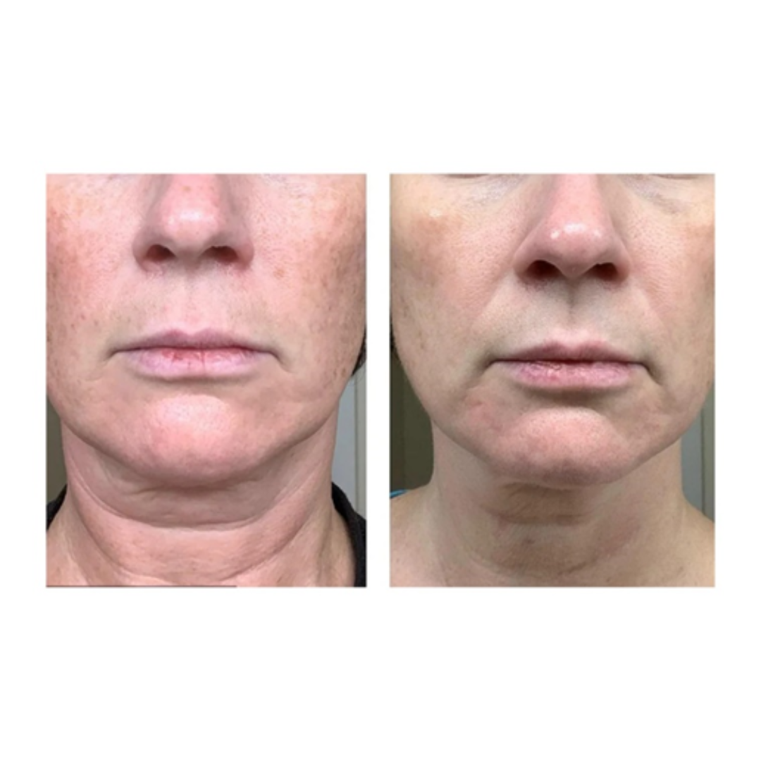 NECK FIRMING CREAM