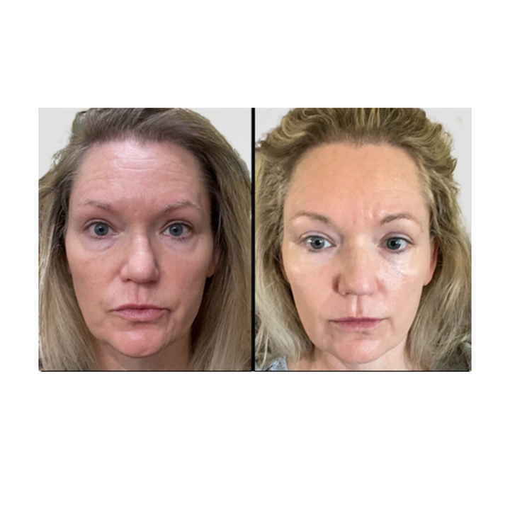 NIACINAMIDE BOOSTER