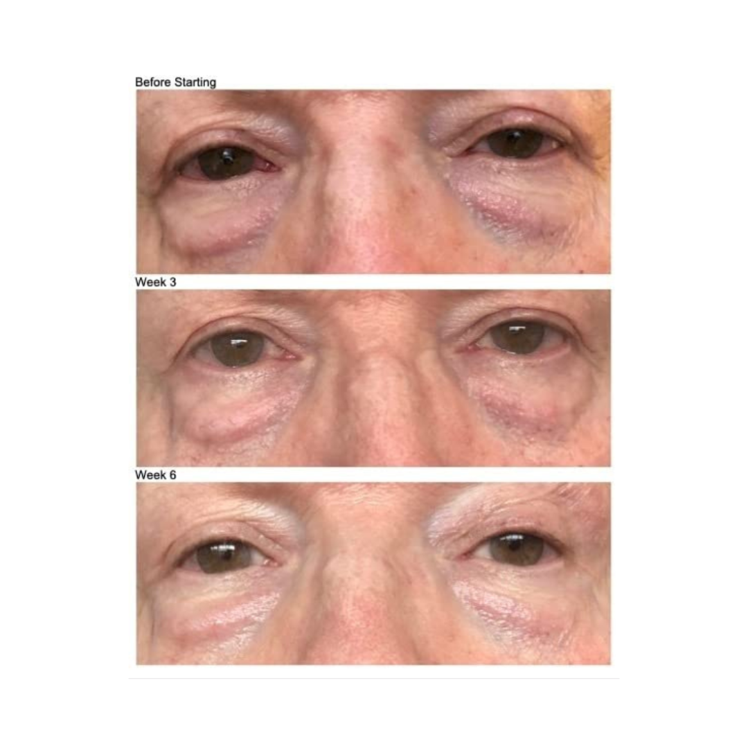 FIRMING EYE CREAM