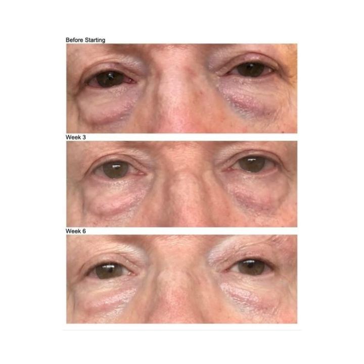 FIRMING EYE CREAM