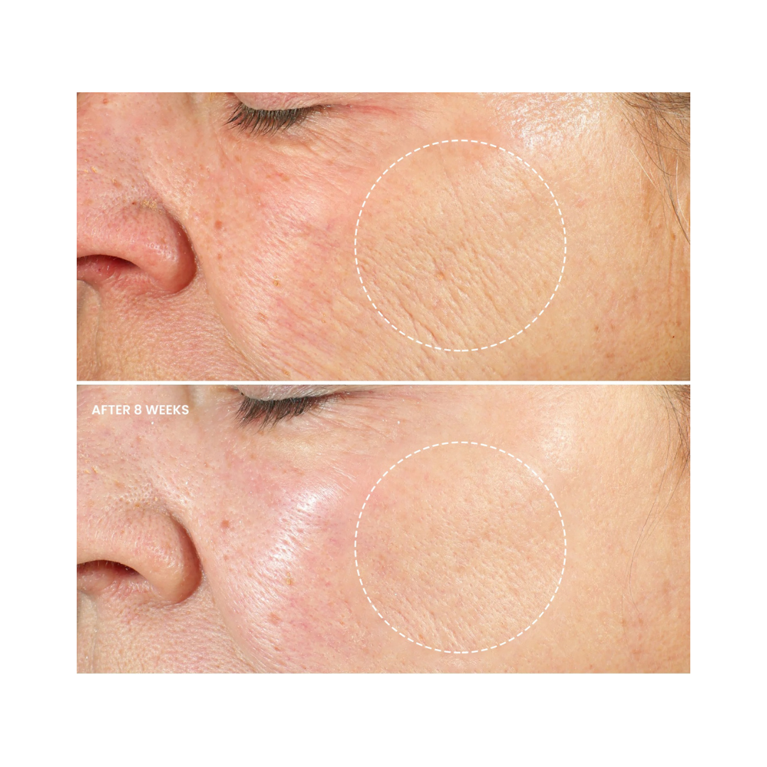 ADVANCED ANTI-AGING RETINOL CREAM