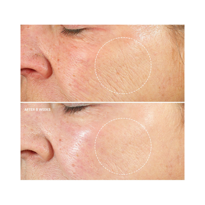 ADVANCED ANTI-AGING RETINOL CREAM