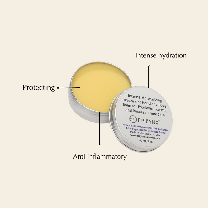 Intense Hydration Shea Butter Moisturizer for Dry Skin