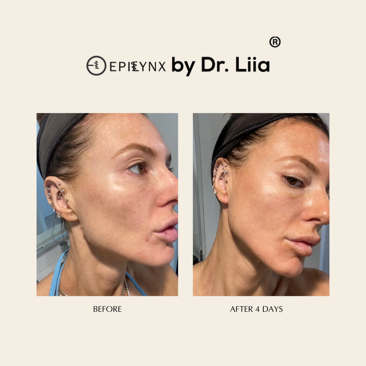 Pore Refining, Illuminating Serum with Lactic and Salicylic Acid - Gentle